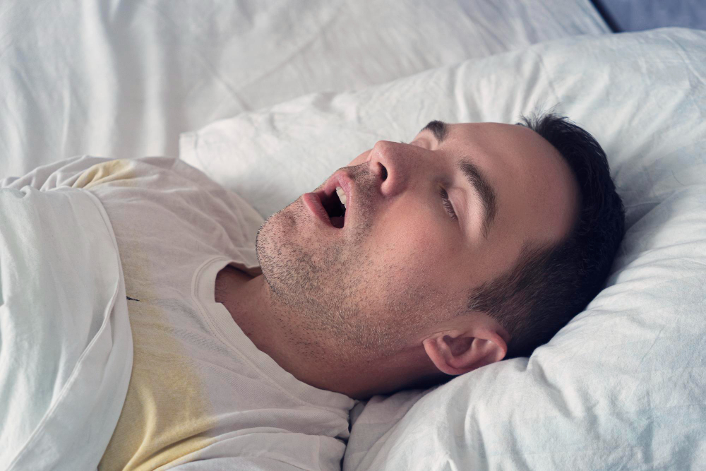 OSA (OBSTRUCTIVE SLEEP APNEA)/ SNORING
